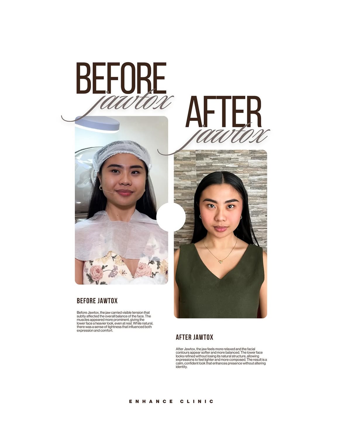 Before & After 1