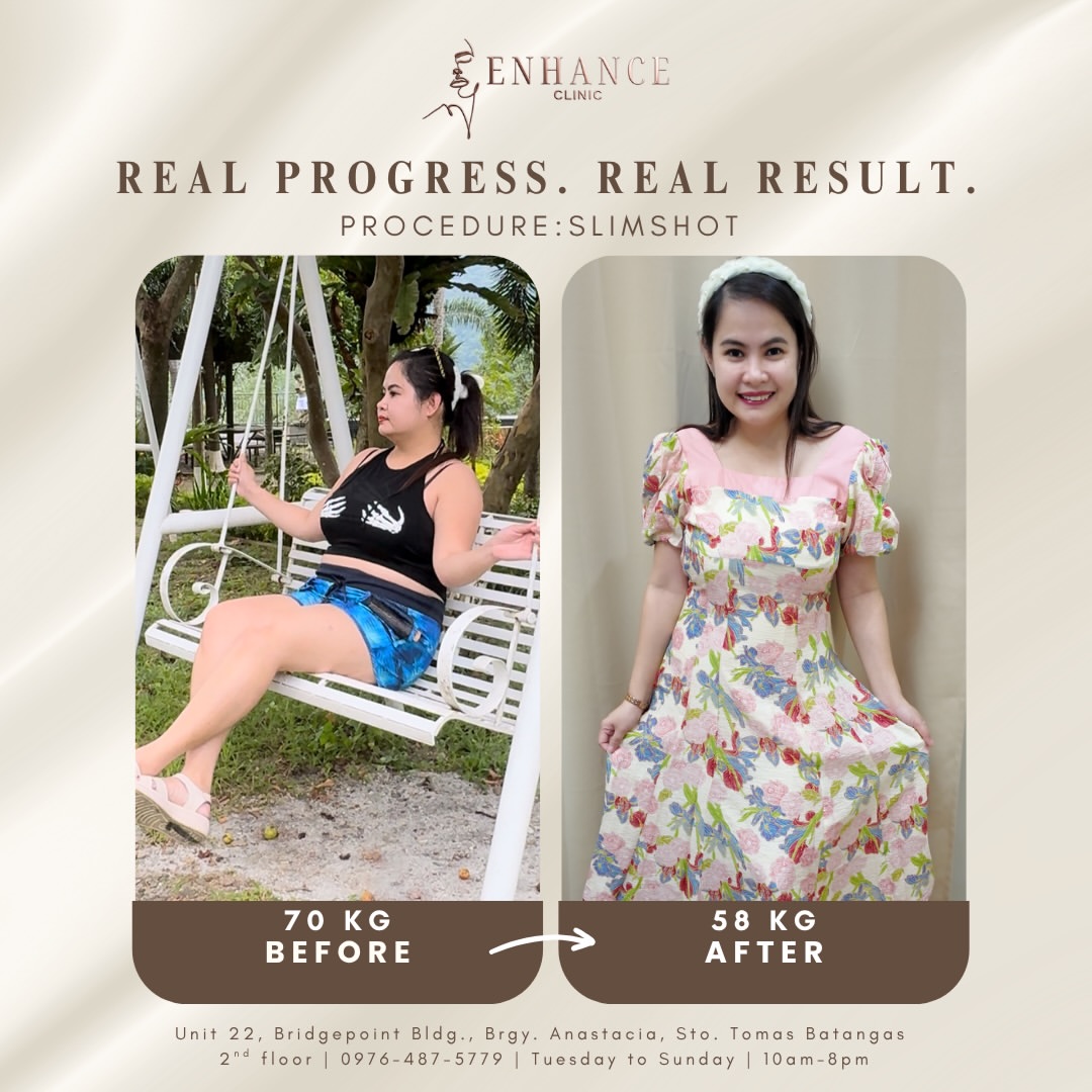 Before & After 4